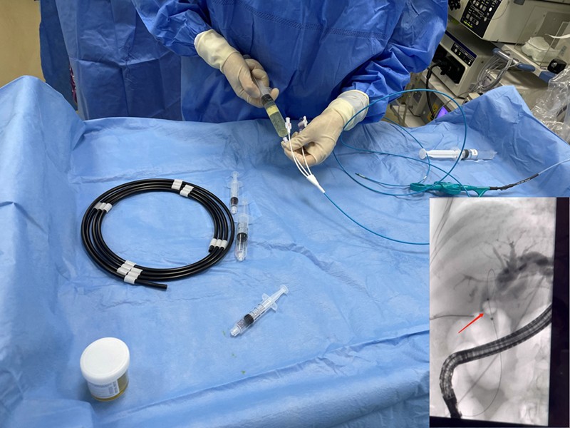 Hangzhou locale top trei spital folosind noastre de unică folosință piatra re...